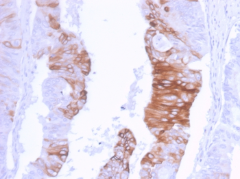 KRT20 Antibody