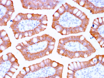 KRT20 Antibody