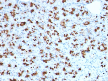 BARX1 Antibody