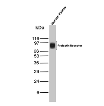 PRLR Antibody