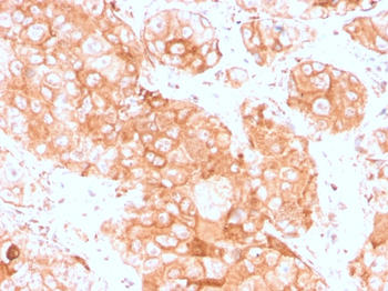 PRLR Antibody