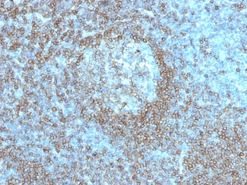 PTPRC Antibody