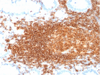 PTPRC Antibody