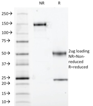S100A1 Antibody