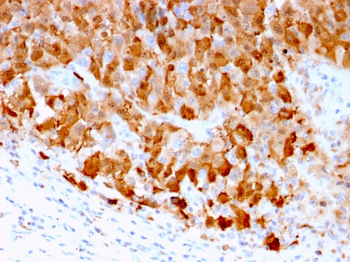 S100A1 Antibody