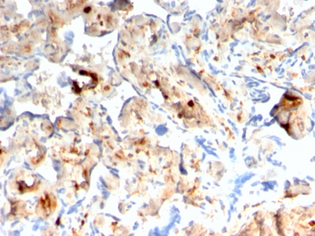 S100A4 Antibody