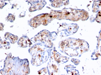 S100A4 Antibody