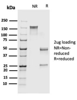 S100A4 Antibody