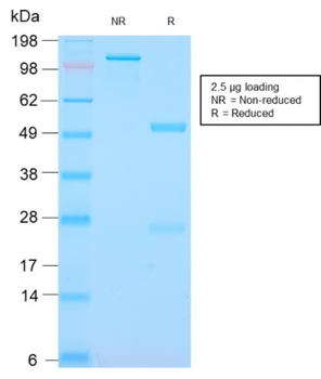 S100A8 Antibody