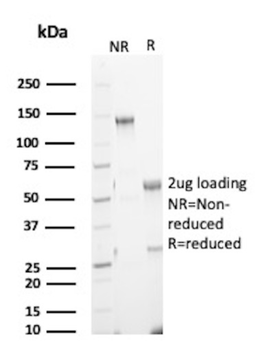 S100A8 Antibody