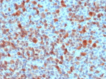 S100B Antibody