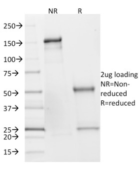 SDHB Antibody