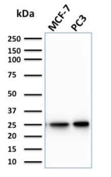 CHP2 Antibody