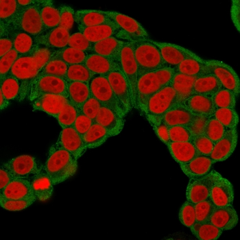 CHP2 Antibody