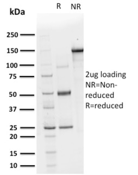 CHP2 Antibody