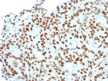 BMI1 Antibody