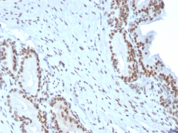 BMI1 Antibody