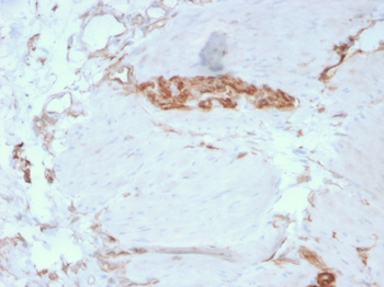 SPTAN1 Antibody