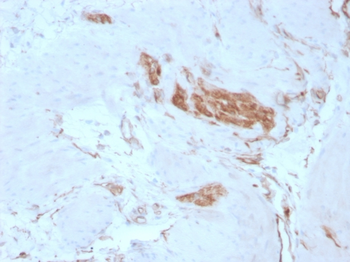 SPTAN1 Antibody