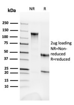SPTAN1 Antibody