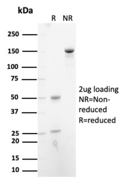 STAT5B Antibody