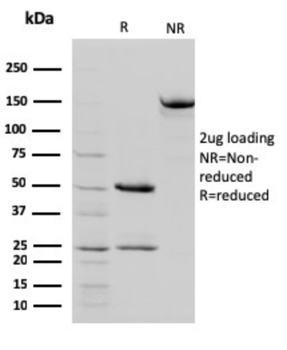 STAT5B Antibody