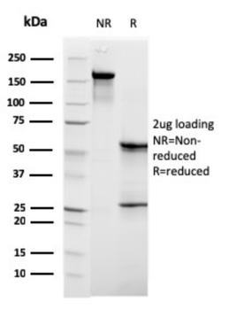 C1QB Antibody