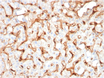 C1QB Antibody