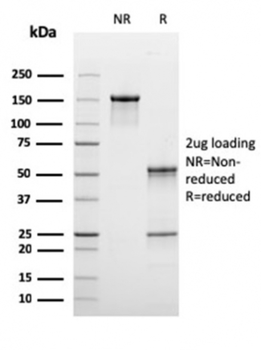 C1QB Antibody