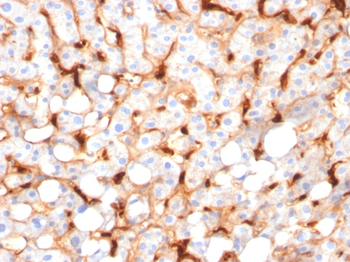 C1QB Antibody