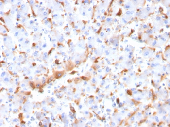 C1QB Antibody
