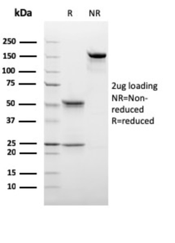 C1QB Antibody