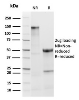 TPO Antibody