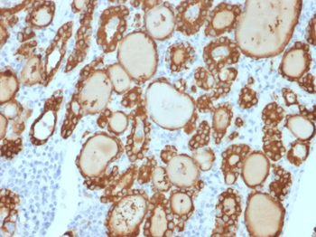 TPO Antibody