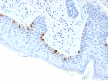TYRP1 Antibody