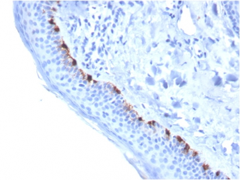 TYRP1 Antibody