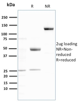 UBB Antibody