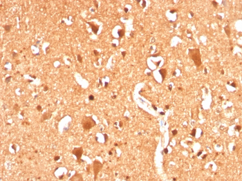 UBB Antibody