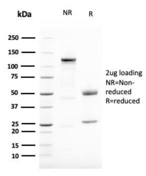 VIM Antibody