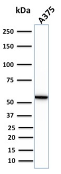 VIM Antibody