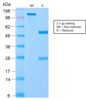 VLDLR Antibody