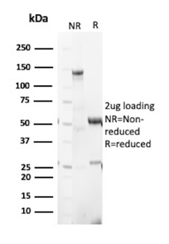 VLDLR Antibody