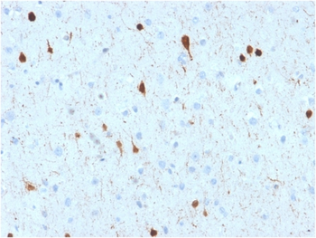 CALB2 Antibody