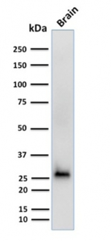 CALB2 Antibody