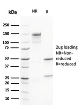CALB2 Antibody