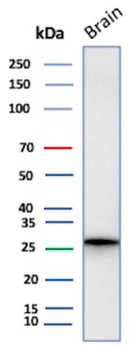 CALB2 Antibody