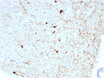 CALB2 Antibody