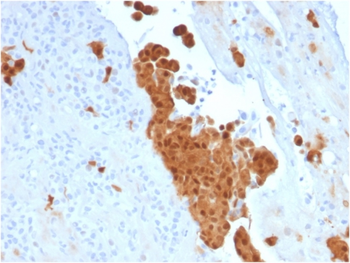 CALB2 Antibody