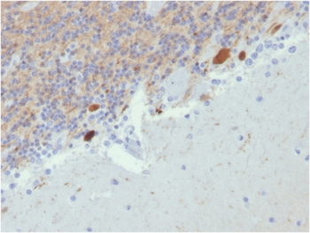CALB2 Antibody