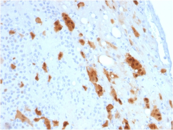 CALB2 Antibody